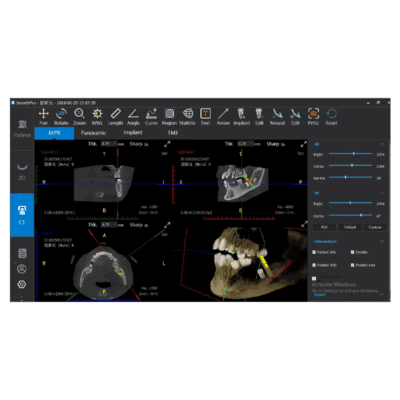 Arquitectura digital de equipo y suministros dentales, mostrando pantallas de tecnología de imagen 3D y tomografía para procedimientos odontológicos precisos.