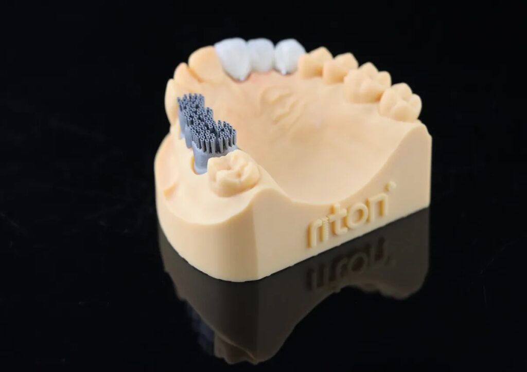 Impresora 3D de metal MLab 15 Protesis dental en modelo de estudio con implantes y coronas, utilizada para planificación y demostración en odontología.