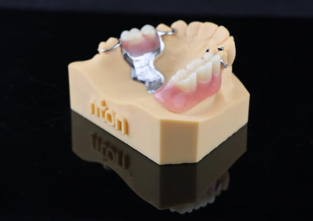 Impresora 3D de metal MLab 14 Prototipo de prótesis dental en modelo de encía con estructura metálica y dientes artificiales, utilizado para planificación y fabricación de restauraciones dentales.