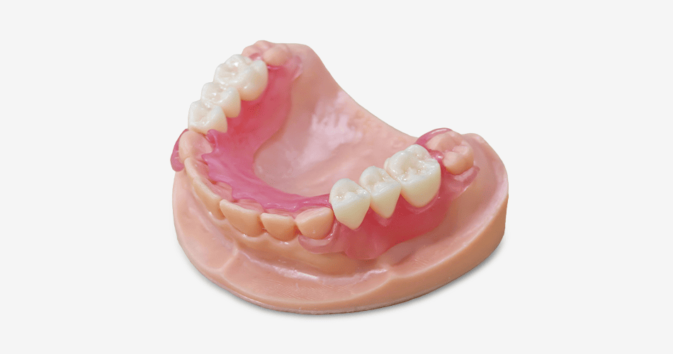 Impresora 3D de resina PioNext Mini 2 Pieza dental removible con encía rosa, ideal para tratamientos protésicos y restaurativos en odontología, mostrando detalles precisos de la estructura dental y encía artificial.