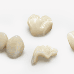 Impresora 3D de resina PioNext Mini 14 Diversos componentes dentales y restauraciones en tonos naturales, ideales para tratamientos odontológicos.