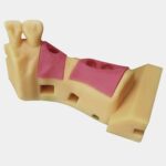 Impresora 3D de resina PioCreat D150 17 Implante dental anatómico en modelo de entrenamiento, utilizado en procedimientos odontológicos para simular la colocación de implantes en la mandíbula.