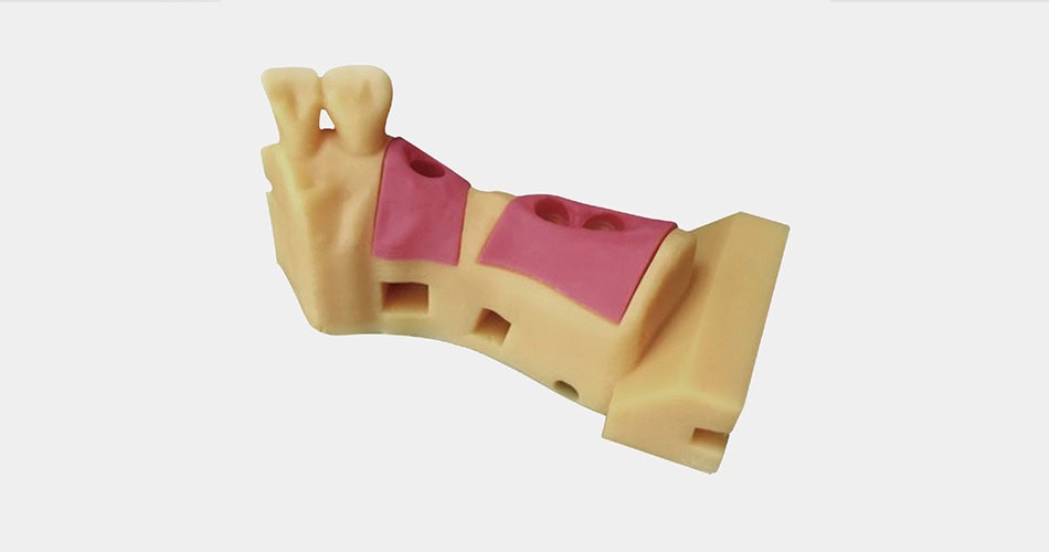 Impresora 3D de resina PioCreat D150 6 Implante dental anatómico en modelo de entrenamiento, utilizado en procedimientos odontológicos para simular la colocación de implantes en la mandíbula.