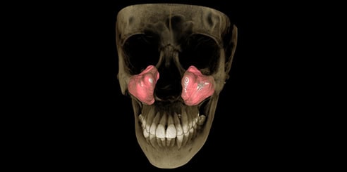 IA + Segmentación de Seno Maxilar